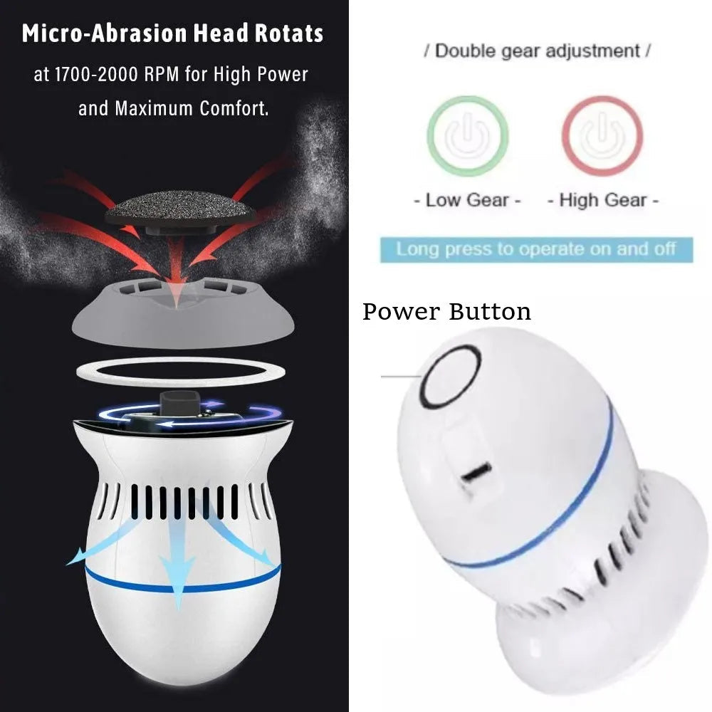 Elektrisk Fotsliper for Effektiv Fotpleie 1