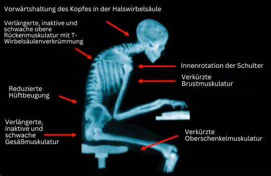 Holdningsbandasje for kvinner og menn med EMS-teknologi 3