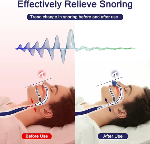 Mikro CPAP Enhet for Snorking Kompakt og Stillegående 3