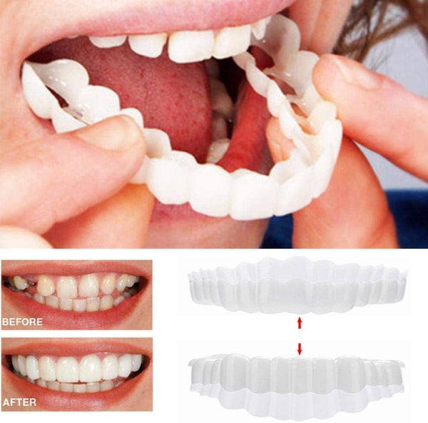 Tannfiner for perfekt smil 0