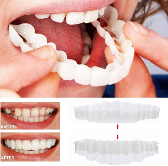 Tannfiner for perfekt smil 0