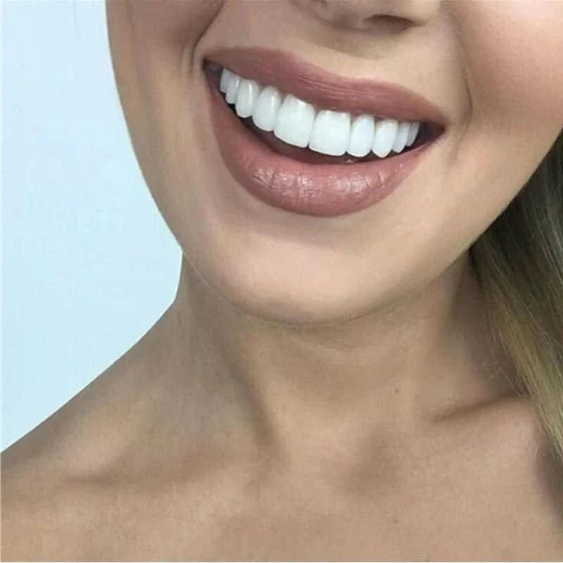 Tannrestaurering for et perfekt smil 2