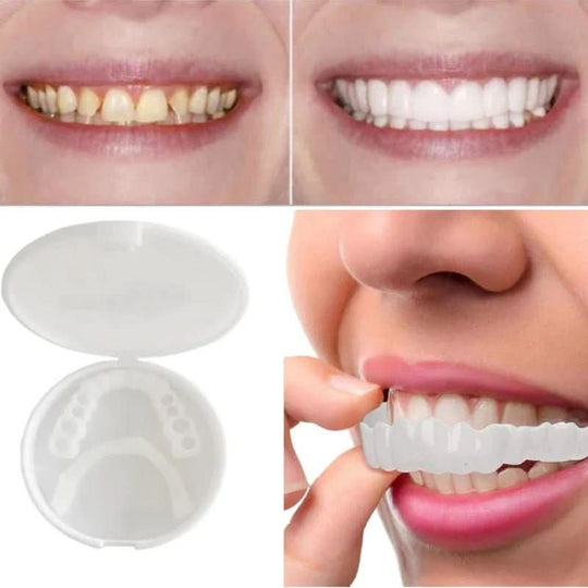 Tannrestaurering for et perfekt smil 3