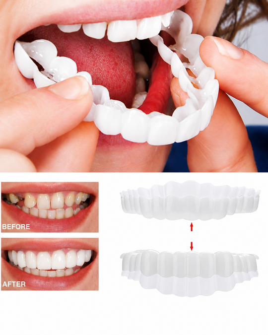 Tannfiner for perfekt smil