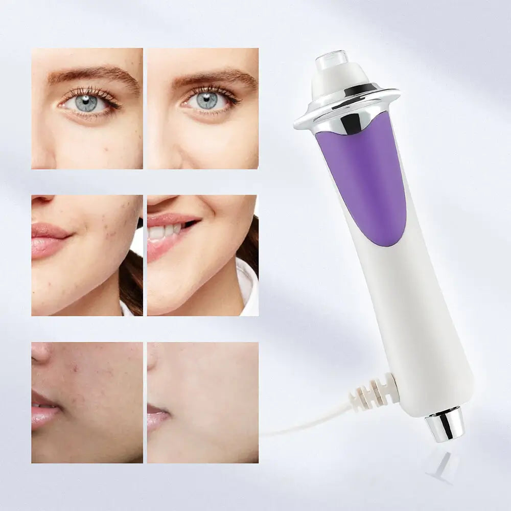 Mesoterapi Beauty Pen